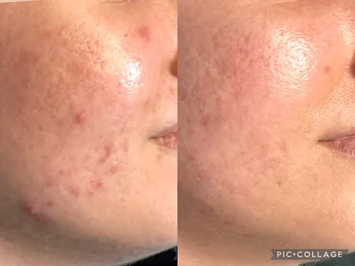 bestheticz Picture 3