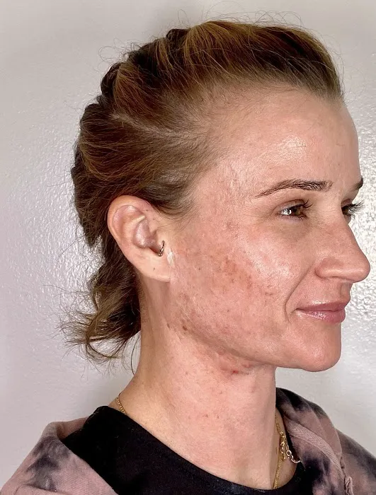 Skin By Shara Aesthetics Picture 3