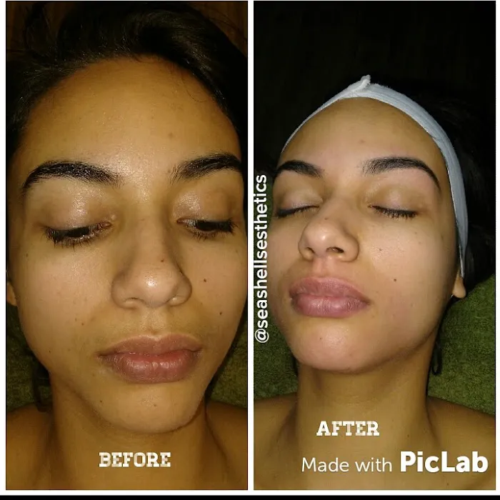 Sea Shells Esthetics Picture 3