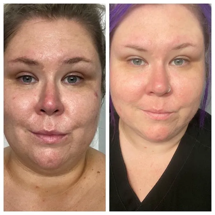 Carmen Christy Skin Picture 7