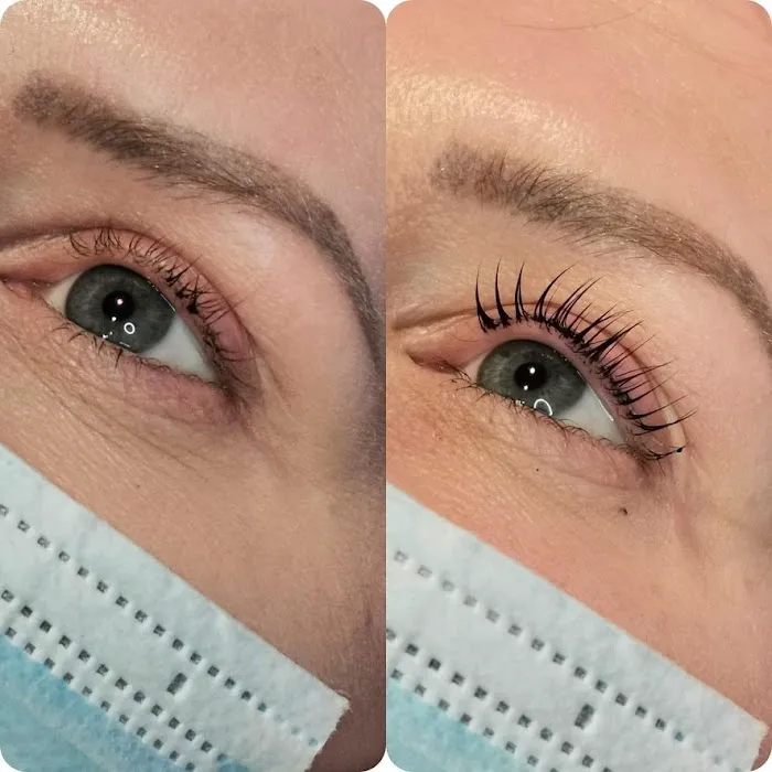 Carmen Christy Skin Picture 4