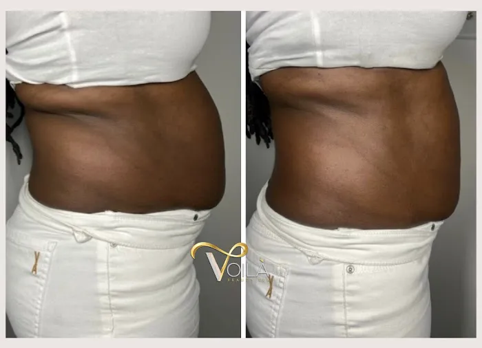 Voilà Beauty Spa Picture 7