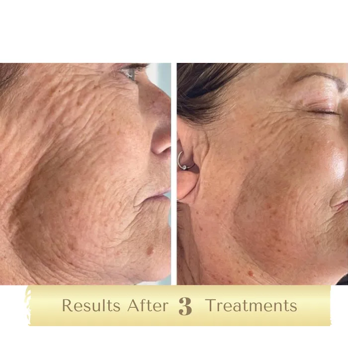 Voilà Beauty Spa Picture 8