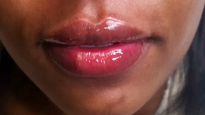 S&N Aesthetics| Med Spa Picture 4