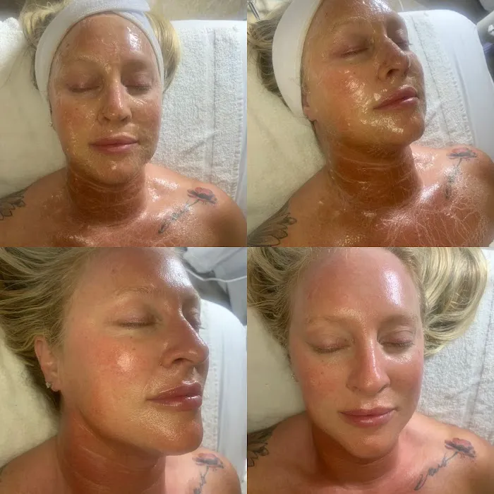 Back 2 Beautiful Esthetics Picture 2