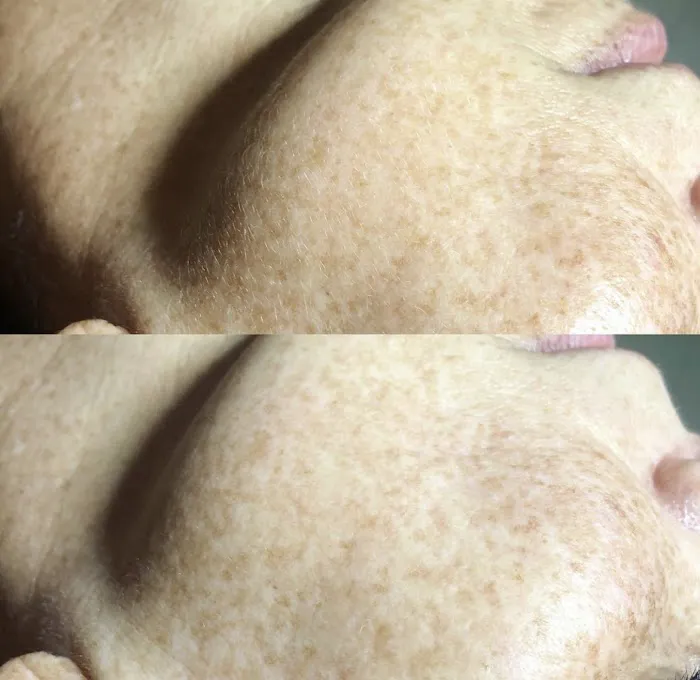 Bloom Aesthetics clt Picture 10