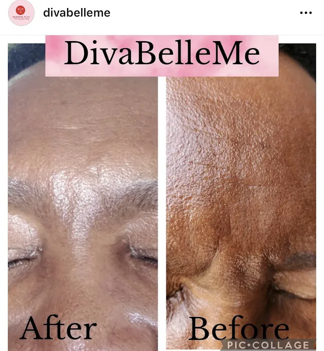 Diva Belle Medical Esthetics & Wellness Picture 6