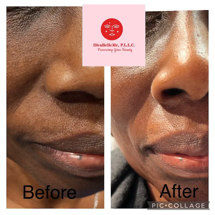 Diva Belle Medical Esthetics & Wellness Picture 3