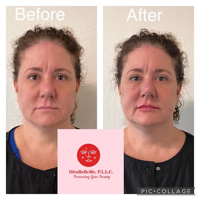Diva Belle Medical Esthetics & Wellness Picture 5