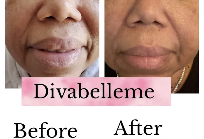 Diva Belle Medical Esthetics & Wellness Picture 10