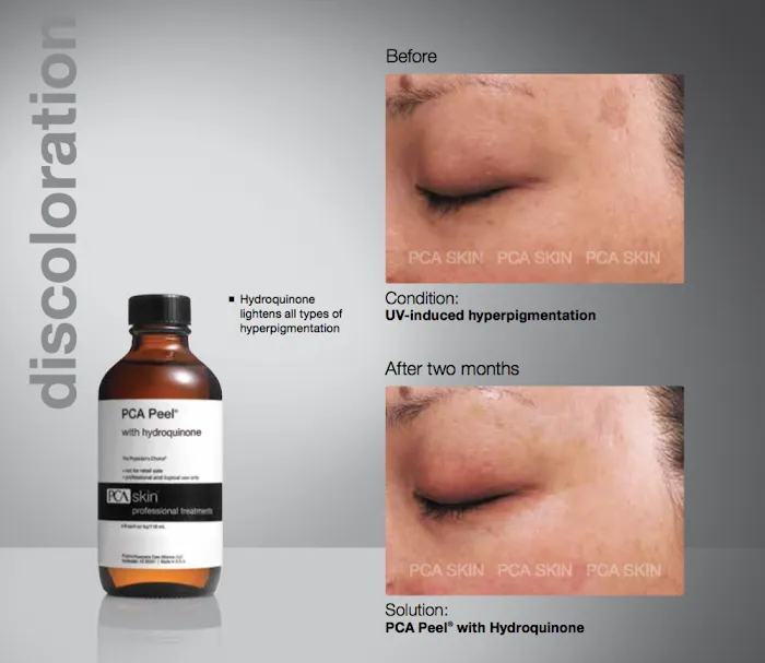 Contour Institute of makeup artistry, skin & Laser Picture 10