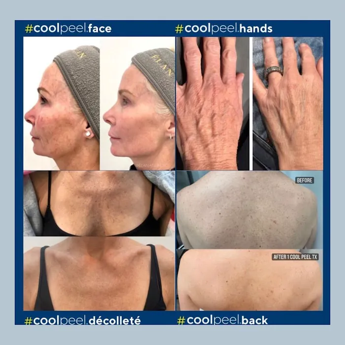 Avi Aesthetics Picture 5