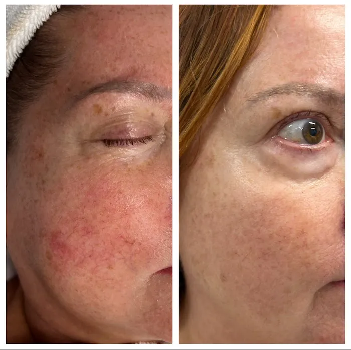 Avi Aesthetics Picture 1