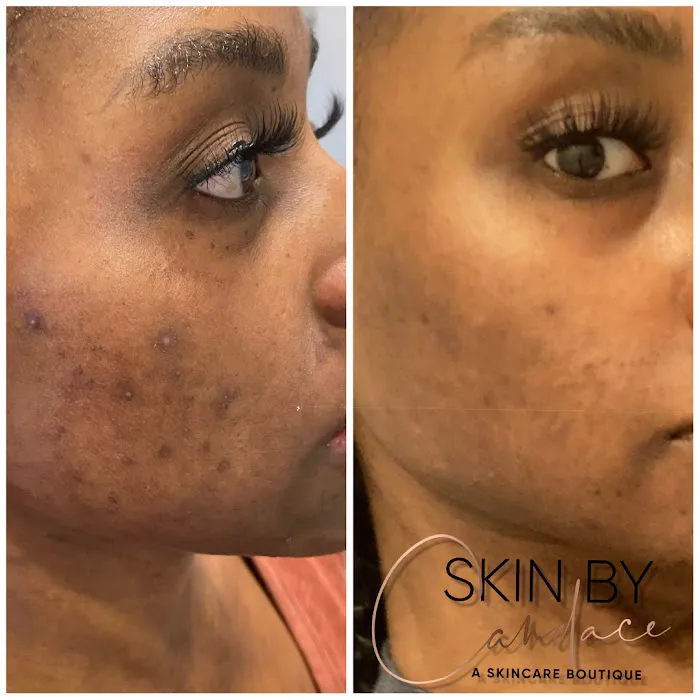 Skin By Candace Picture 2