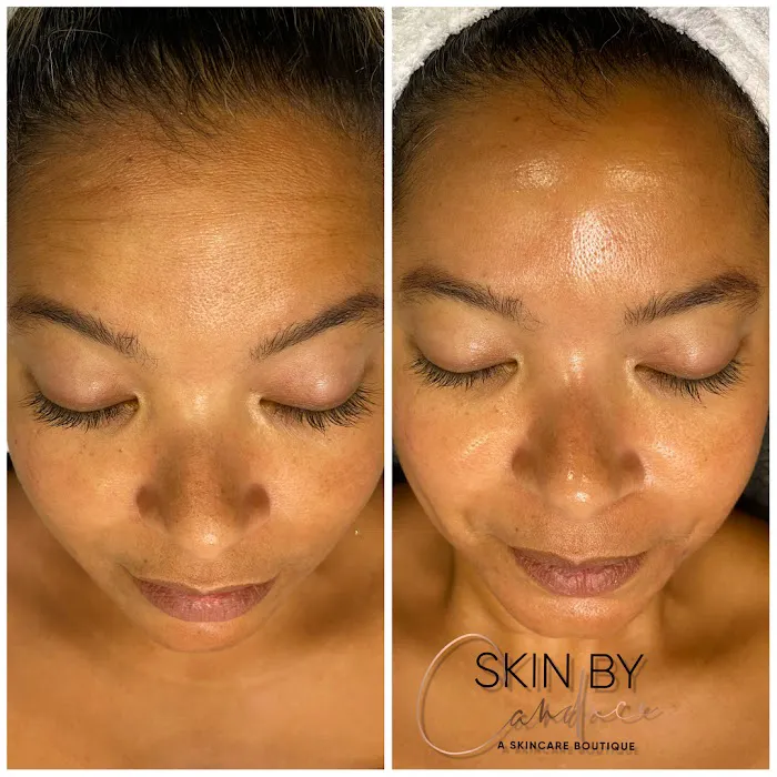 Skin By Candace Picture 3