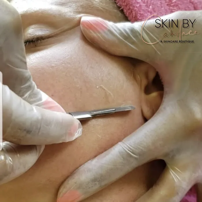 Skin By Candace Picture 6