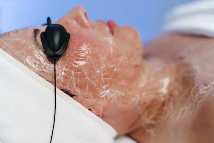 Facial Fitness - Skin Tightening Picture 7