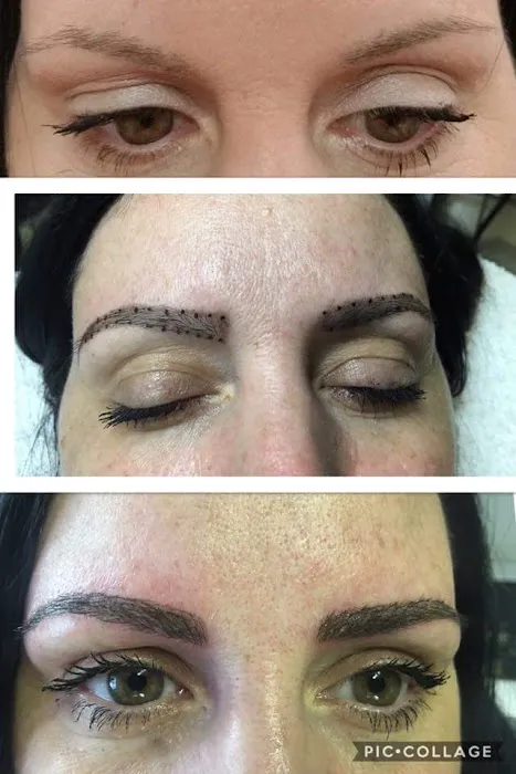 Innovative Aesthetics Skin Care Picture 4