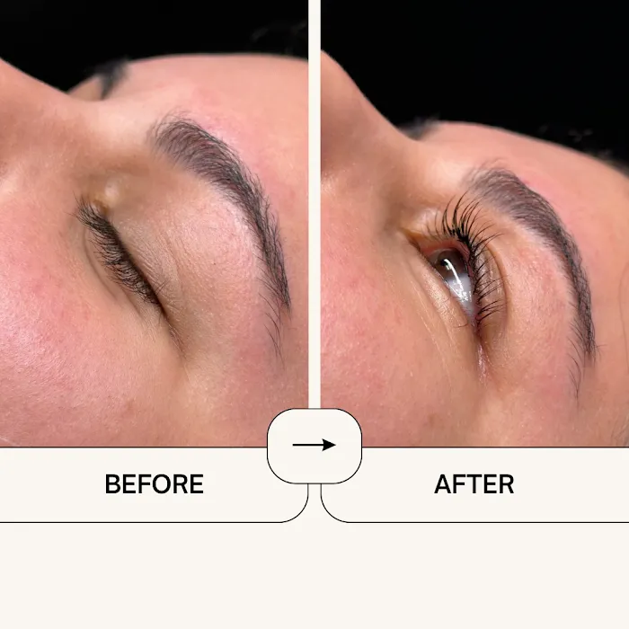 Bare Aesthetics By Chloe Picture 6