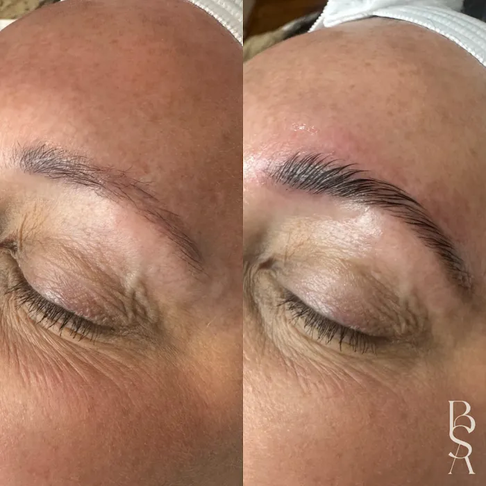 Bare Skin Aesthetics Picture 9