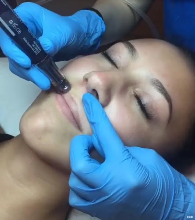 Love Your Skin Too Picture 3