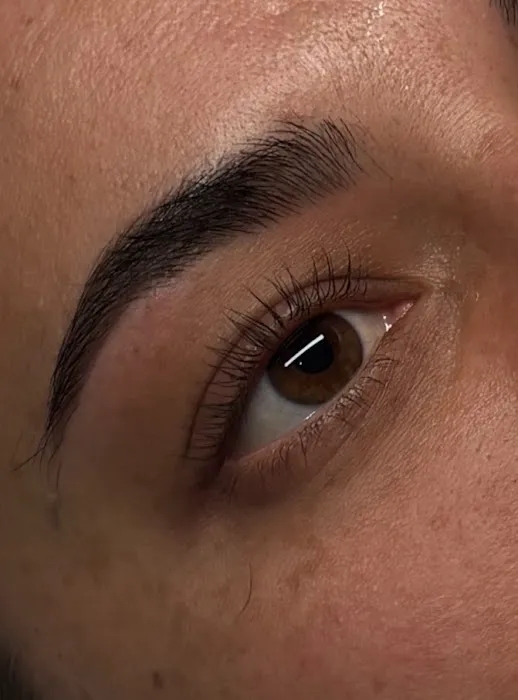 Spotlight Aesthetics Picture 5