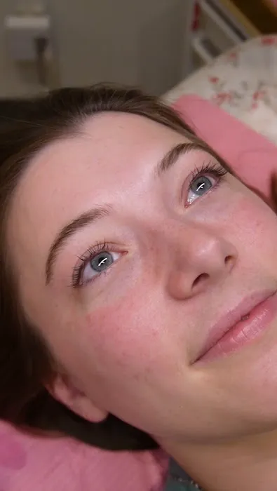 Spotlight Aesthetics Picture 4