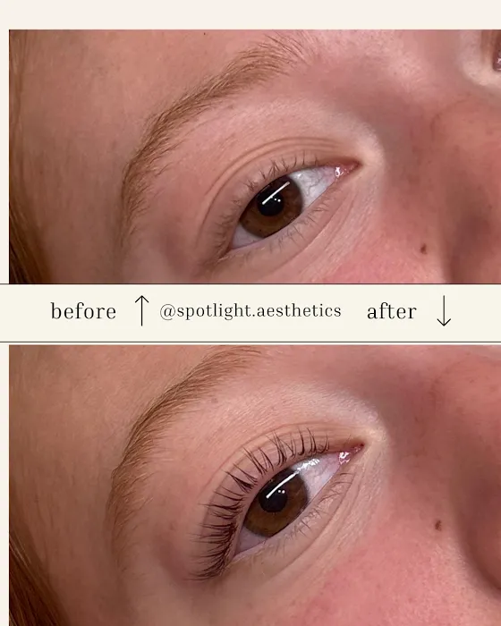 Spotlight Aesthetics Picture 3