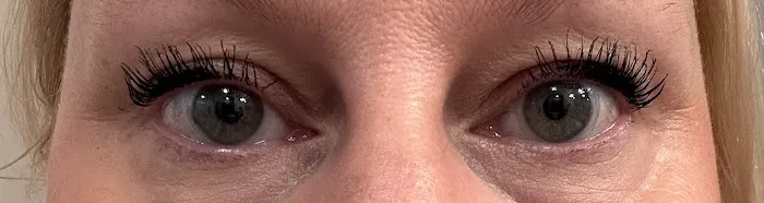 Spotlight Aesthetics Picture 6