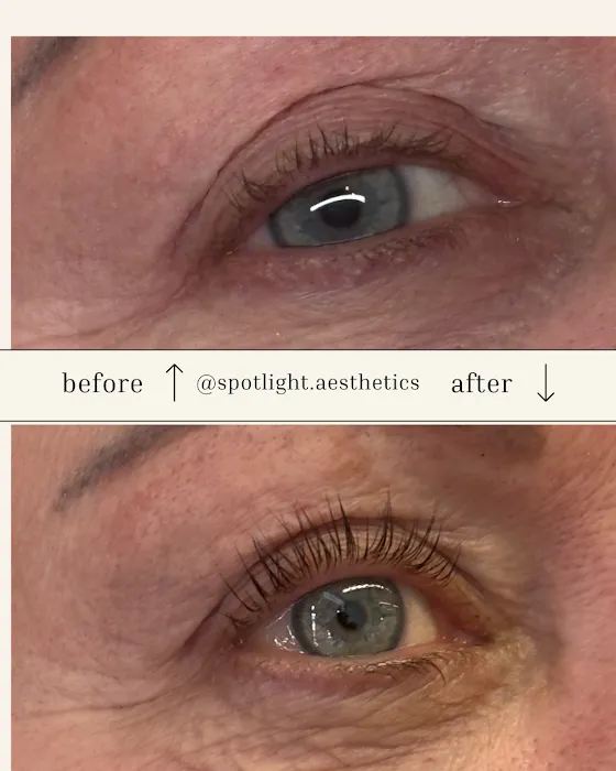 Spotlight Aesthetics Picture 8