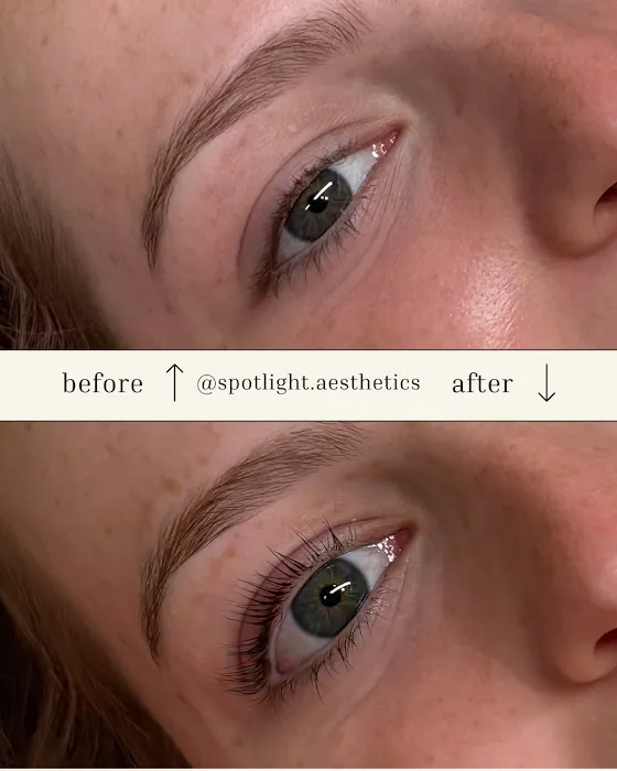 Spotlight Aesthetics Picture 9