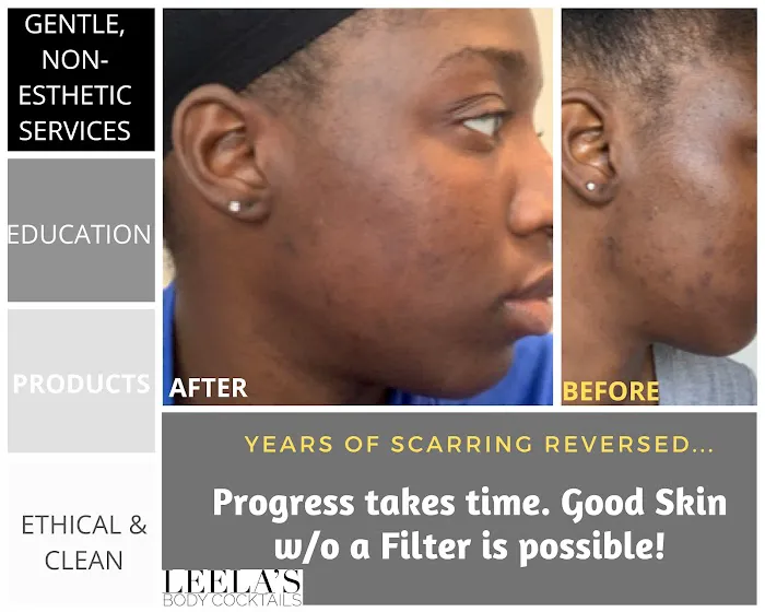 AYANNA DENISE SKIN Picture 8