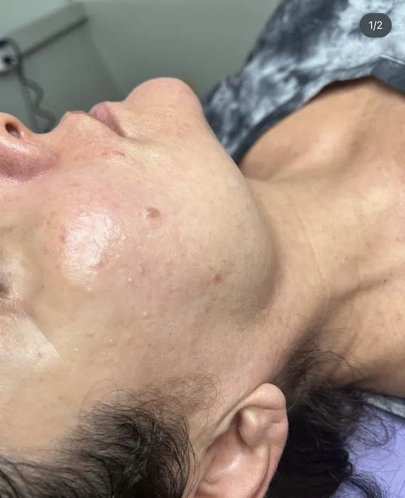 Bare Body Skinn Picture 4