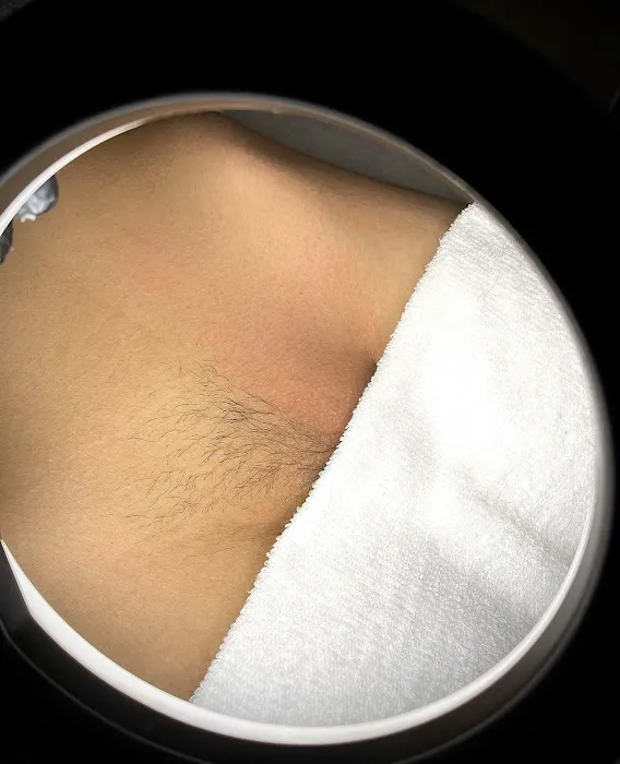 Bare Body Skinn Picture 3