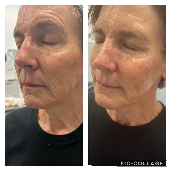 Bliss Wellness and Aesthetic Studios Picture 3