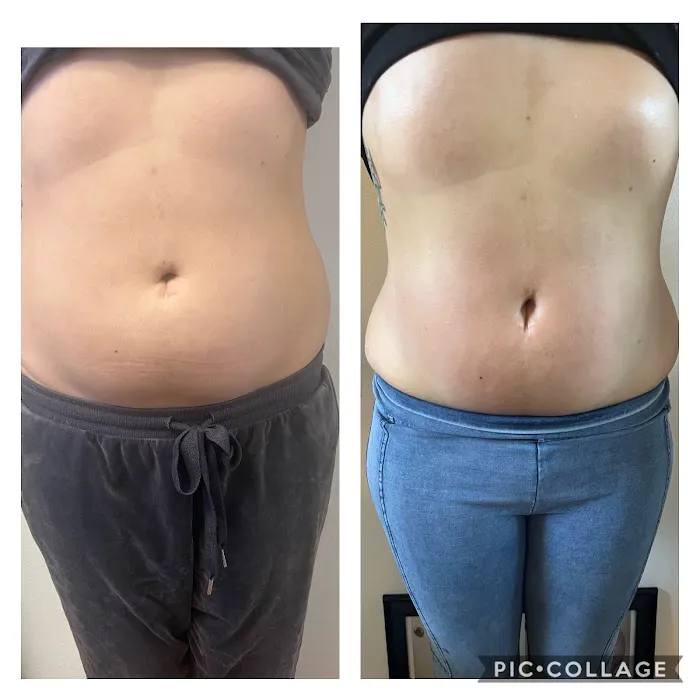 Bliss Wellness and Aesthetic Studios Picture 6