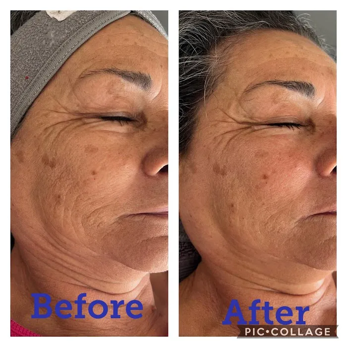 Bliss Wellness and Aesthetic Studios Picture 8