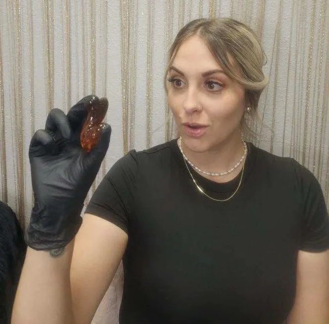 Epidermal Love Picture 1