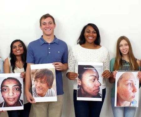 ABQ Skin Care & Acne Clinic