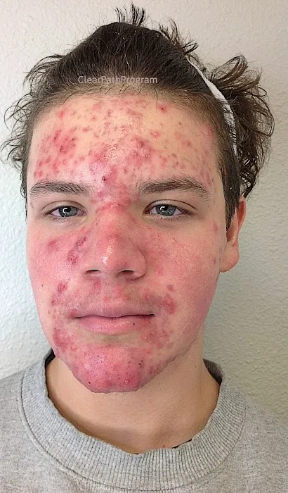 ABQ Skin Care & Acne Clinic Picture 6