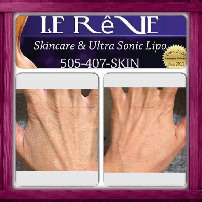 Le Rêve Skin Care Picture 4