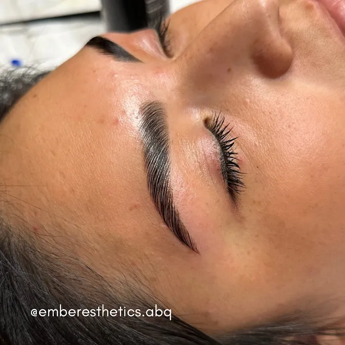 Ember Esthetics Picture 7