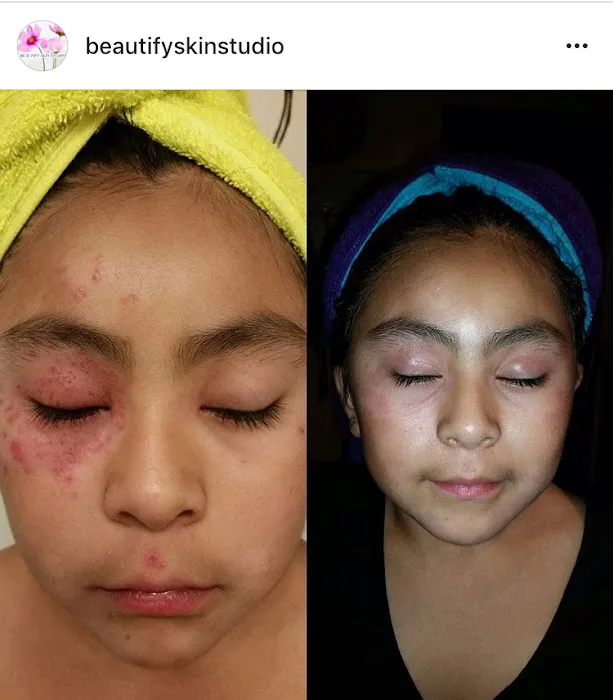 Beautify Skin Studio Picture 4