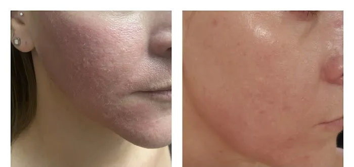 The Facial Bar Picture 7