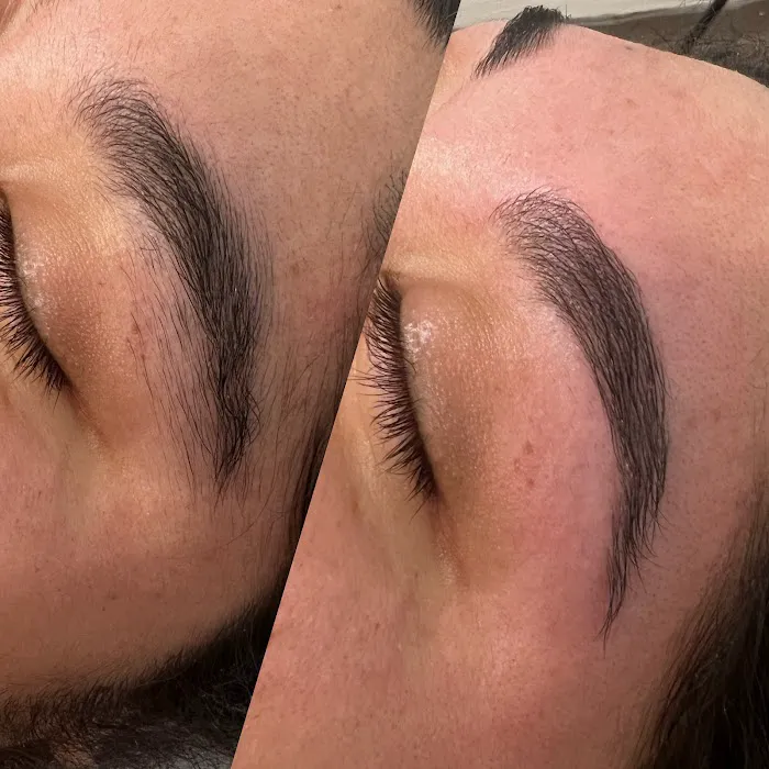 L.R. Acne Lab Picture 3