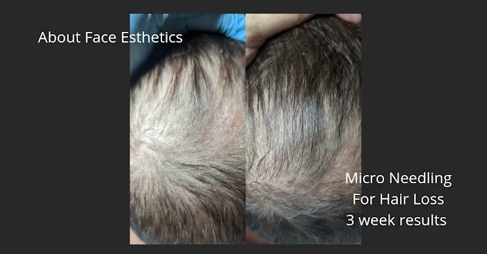 About Face Esthetics Picture 7