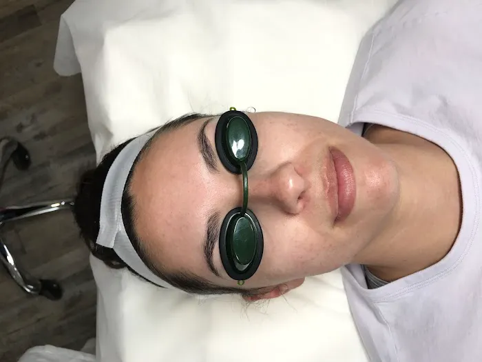 Face Five Acne Clinic Picture 4