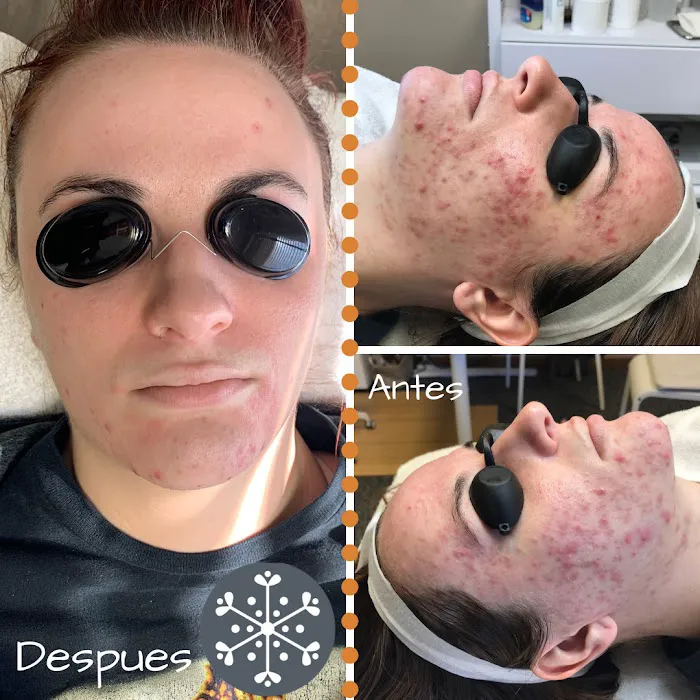 Face Five Acne Clinic Picture 6