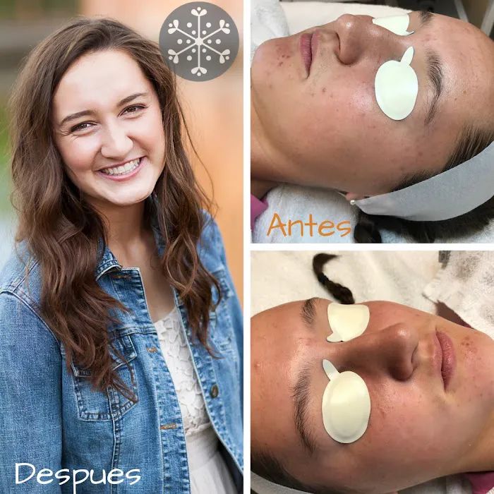 Face Five Acne Clinic Picture 8