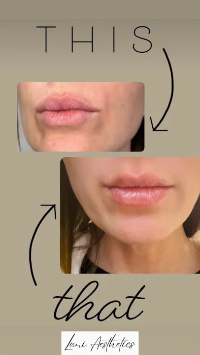 Lani Aesthetics Picture 1